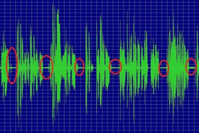 Análises de áudio apontado por André Fernandes como deepfake têm resultados divergentes