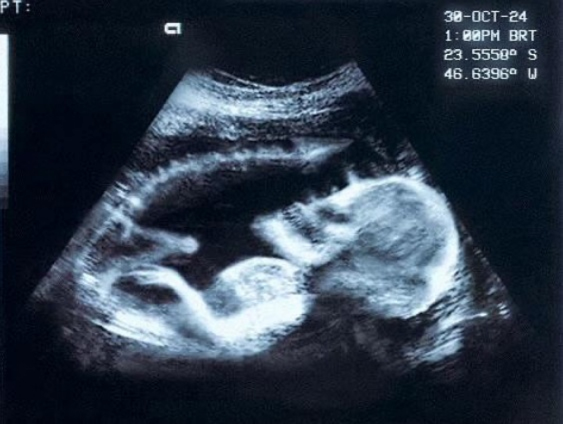 Anitta aumenta mistério sobre suposta parceira musical com The Weeknd - Reprodução/Instagram