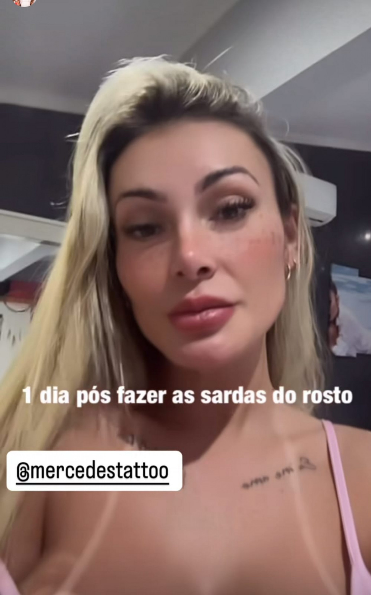 Andressa Urach faz tatuagem de sardas no rosto - Reprodução/Instagram