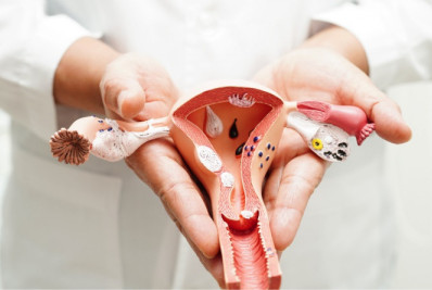 Câmara dos Deputados aprova criação de programa para diagnosticar e tratar adenomiose