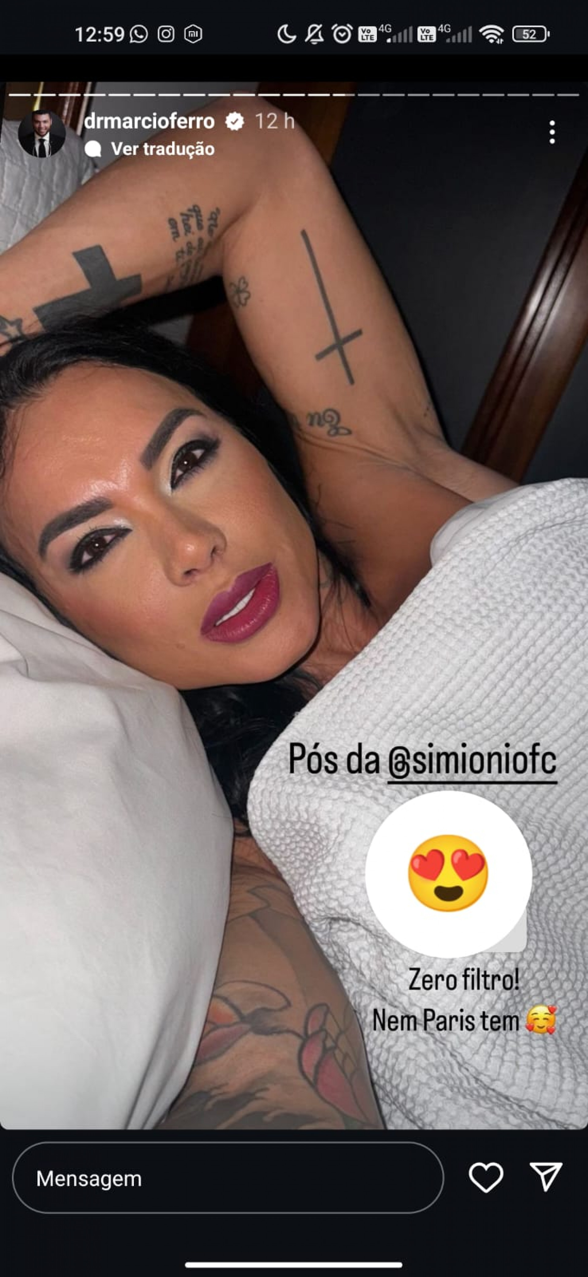 Kamila Simioni choca web ao exibir resultado de harmonização facial - Foto: Reprodução
