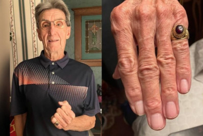 Bizarro! Homem recupera anel de formatura 47 anos após perdê-lo no mar