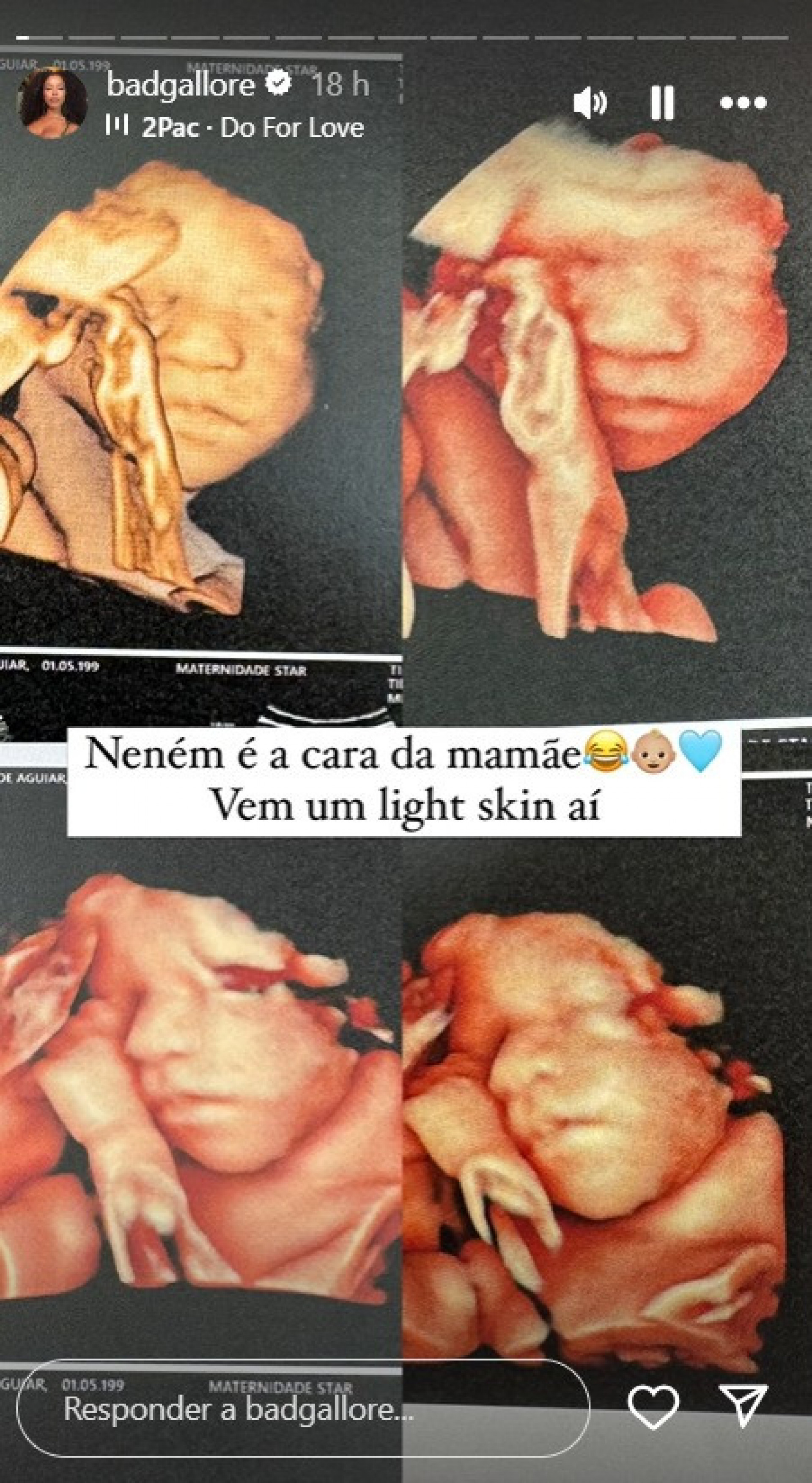 Lorena Maria via stories - Reprodu&ccedil;&atilde;o Instagram