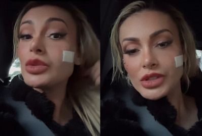 Andressa Urach leva pontos no rosto depois de briga com Juju Ferrari