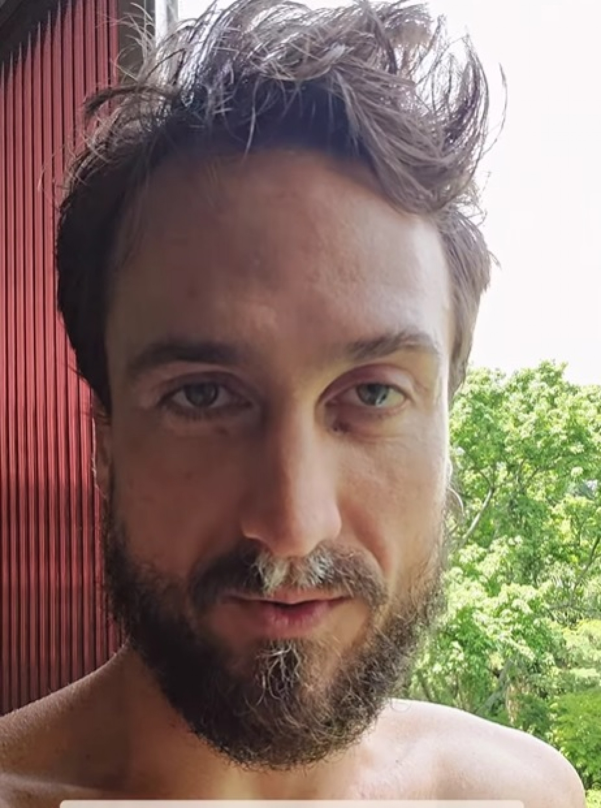  Igor Angelkorte - Reprodução do Instagram