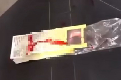 Homem é atingido por bala perdida em tentativa de assalto na Penha