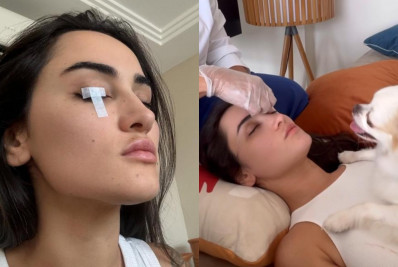 Gabi Melim compartilha luta contra paralisia de Bell e alerta sobre sintomas