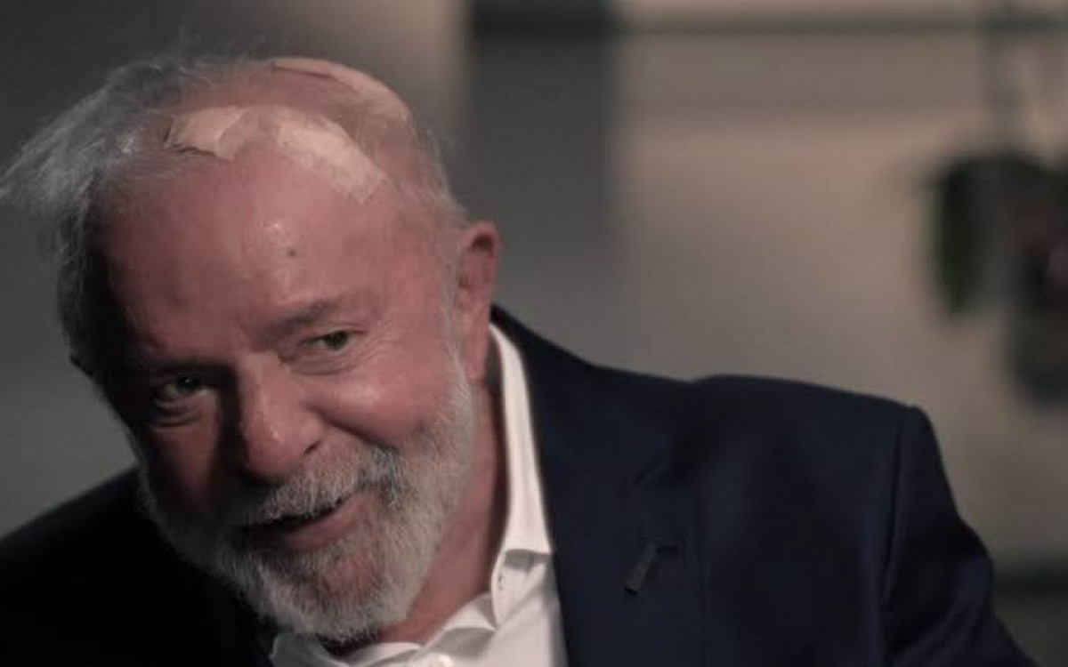 Presidente Lula mostra curativo durante entrevista - Reprodução/TV Globo