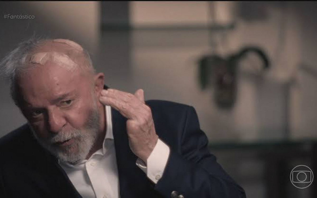 Presidente Lula mostra curativo durante entrevista - Reprodução/TV Globo