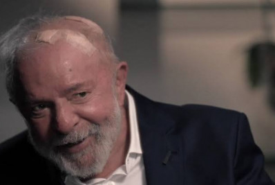 Após receber alta, Lula mostra curativos na cabeça e afirma estar 'totalmente bem'