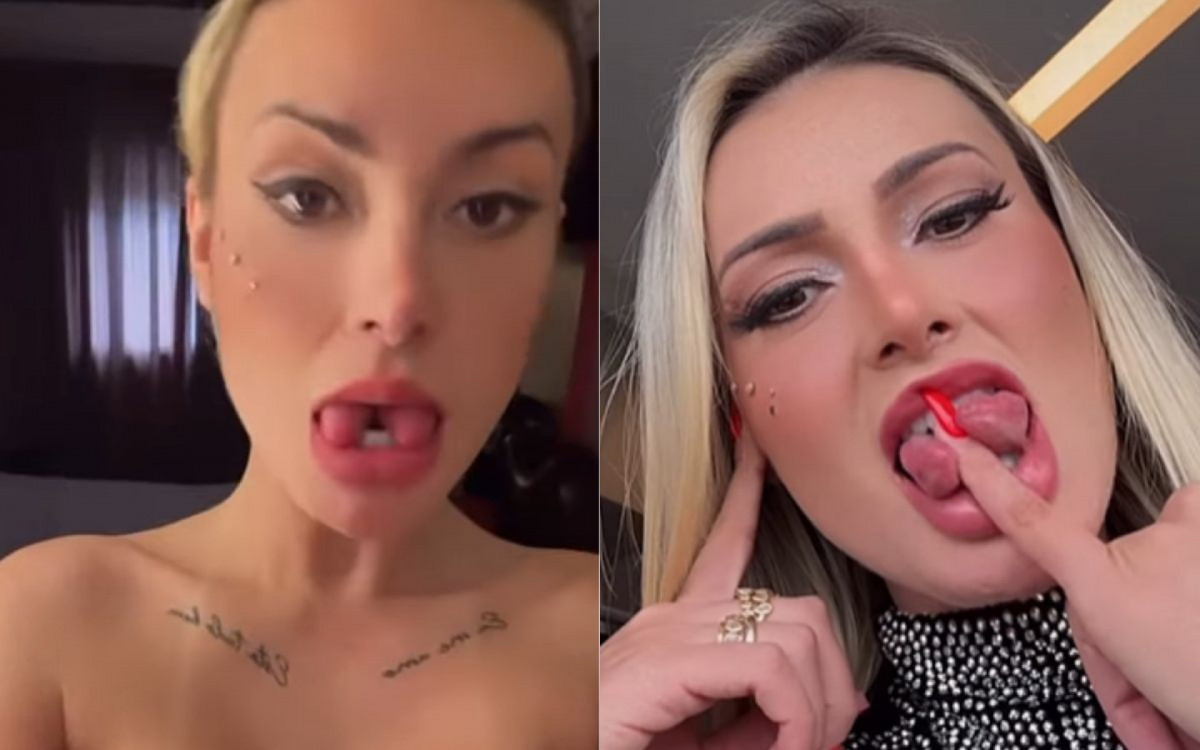 3 ? A criadora de conteúdo adulto Andressa Urach recorrentemente esteve envolvida em polêmicas em 2024. Uma das que mais chamou a atenção dos internautas foi o procedimento de modificação corporal em que dividiu sua língua em duas partes. Em julho, ela compartilhou a novidade e o passo a passo da recuperação com os seguidores
