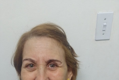 Prefeitura de Volta Redonda entrega primeiras próteses oculares para pacientes do Sul Fluminense