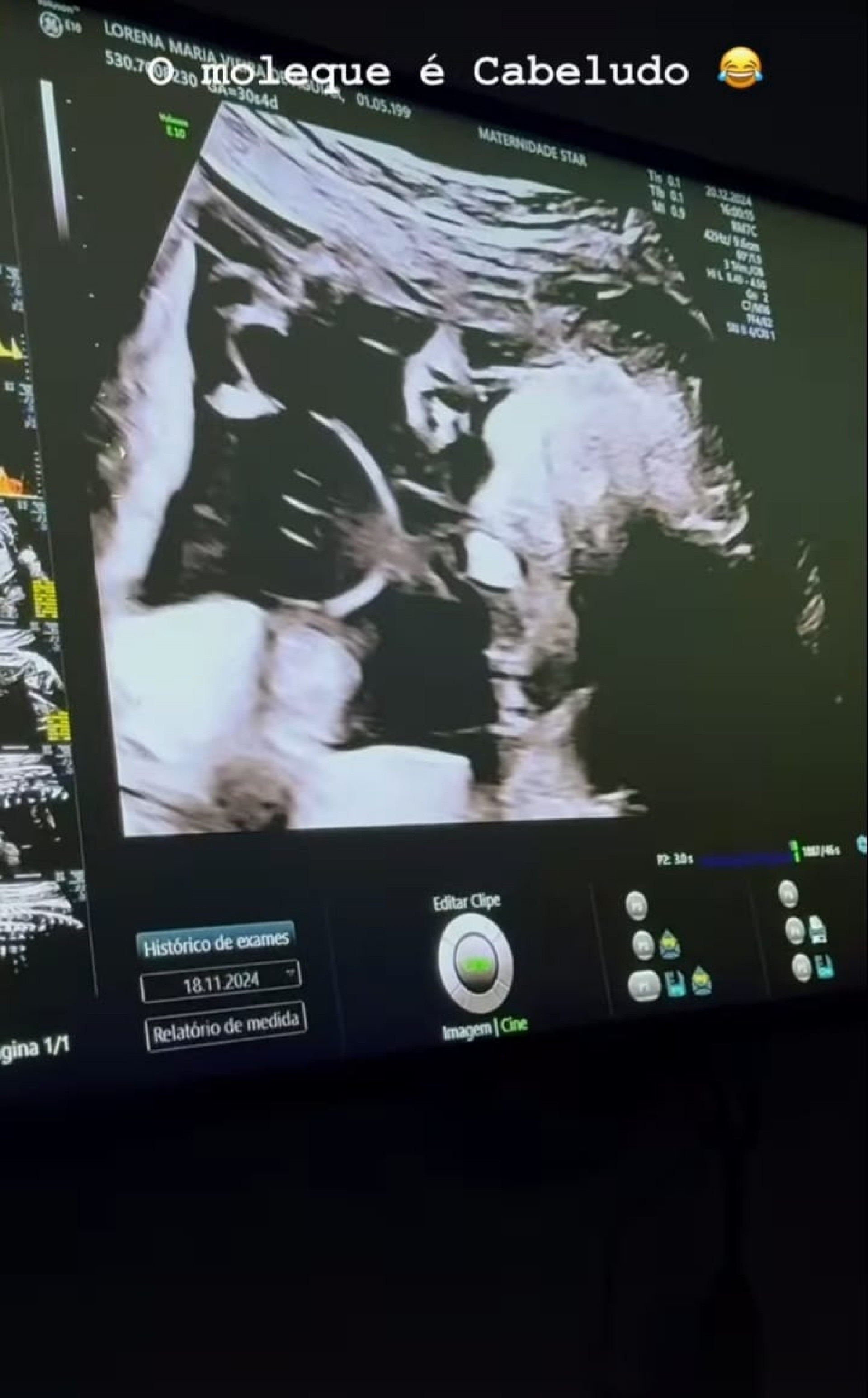 Ultrassom do bebê de MC Daniel e Lorena Maria  - Reprodução/Instagram