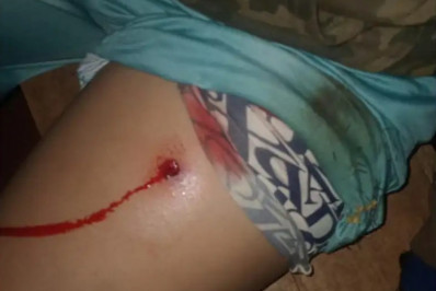 Novo ataque no Paraná deixa mais quatro indígenas feridos