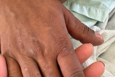 Homem é preso após torturar a companheira com choques elétricos