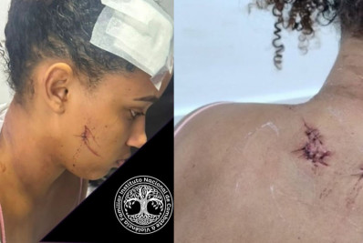 Jovem é esfaqueada pelo ex em Paciência: 'Não me matou porque as facas quebraram'
