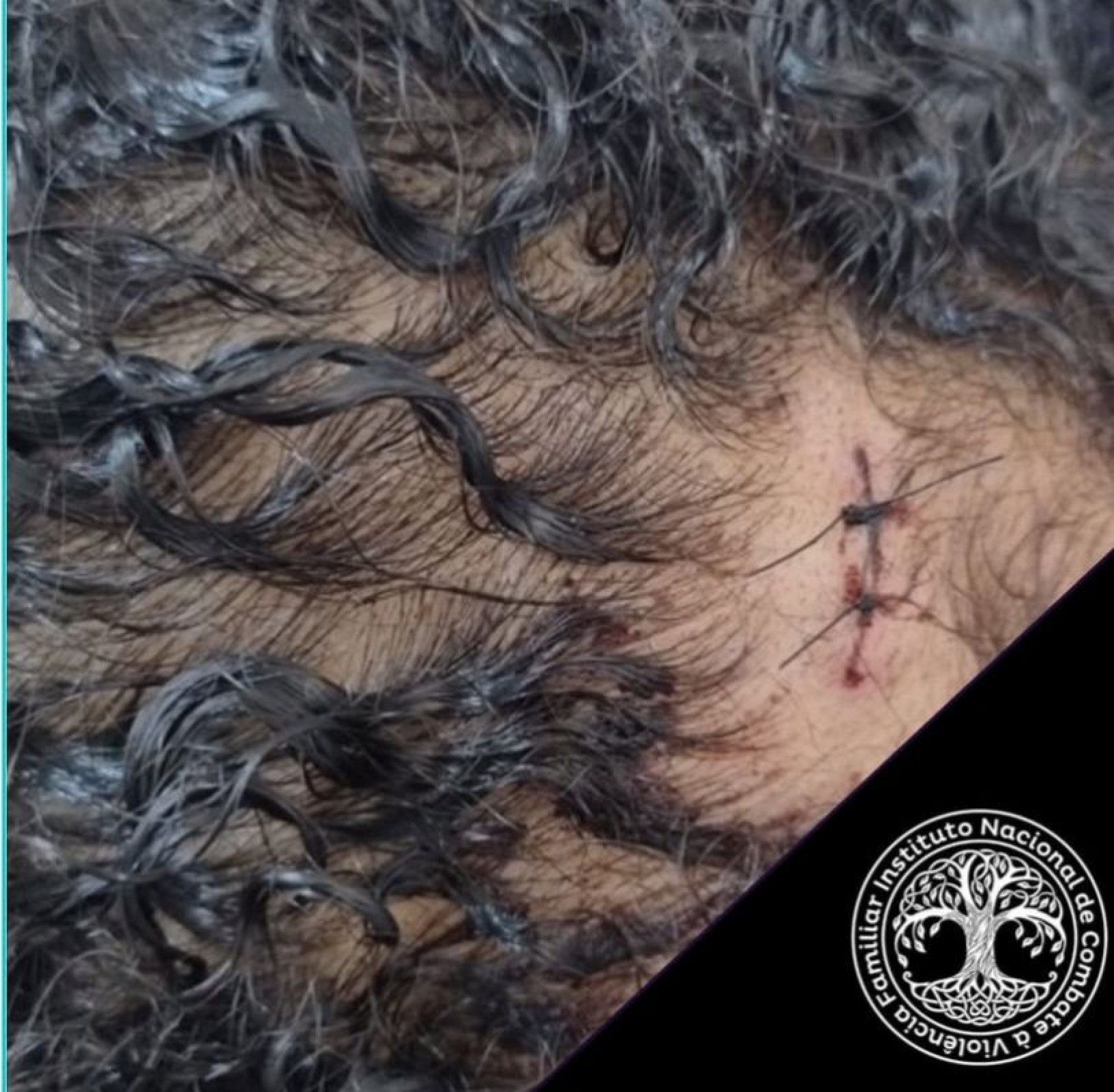 Ana Beatriz Santos da Silva, de 23 anos, foi esfaqueada e agredida a socos pelo ex-companheiro  - Divulgação