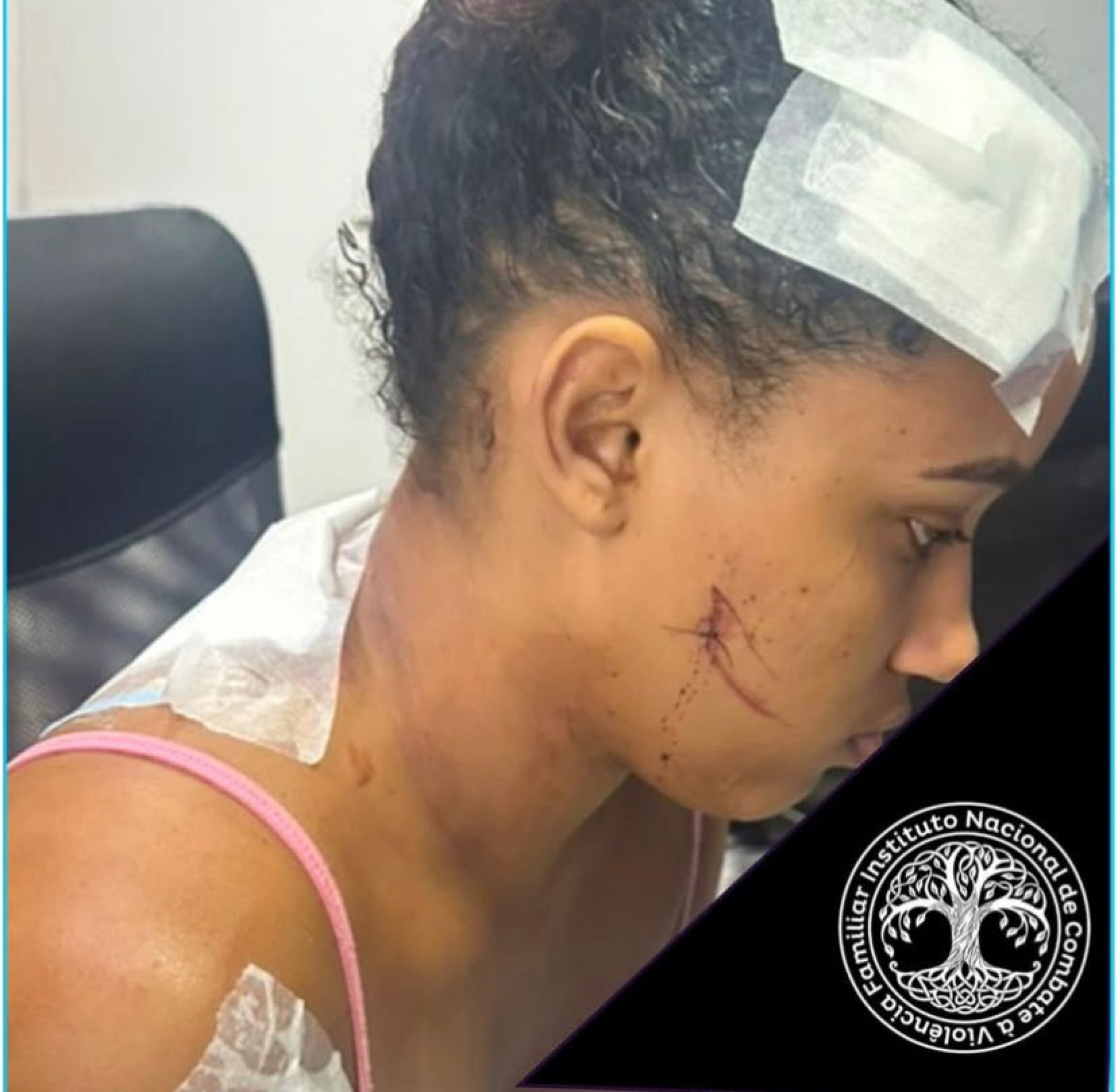 Ana Beatriz Santos da Silva, de 23 anos, foi esfaqueada e agredida a socos pelo ex-companheiro  - Divulgação