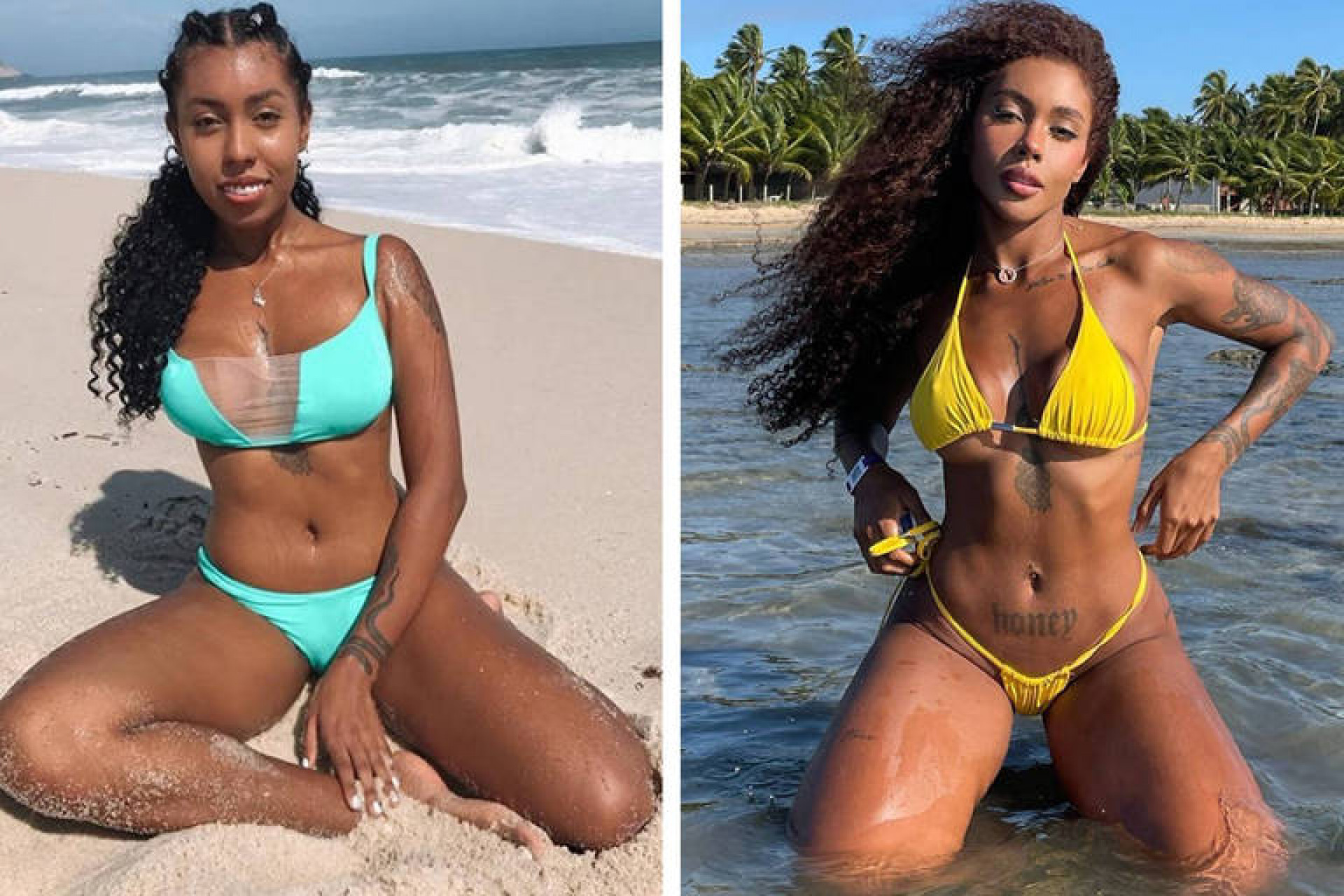 Giovanna Jacobina explica cirurgia ortognática após fotos antigas viralizarem - Reprodução / Instagram 