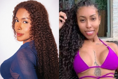 Giovanna Jacobina explica cirurgia ortognática após fotos antigas viralizarem: 'Meu antes é pavoroso'