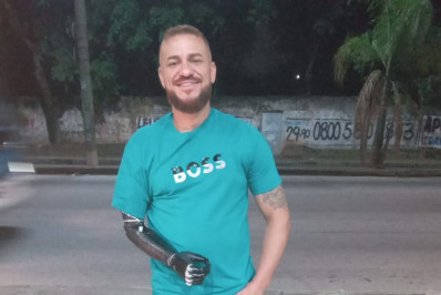 PM reformado recebe prótese elétrica para braço amputado: 'Mudou minha vida'