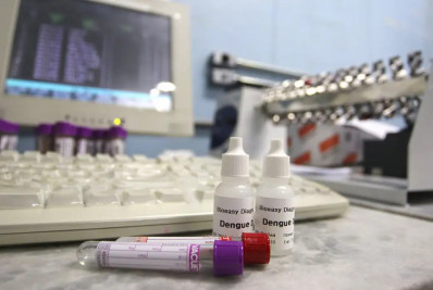 Ministério da Saúde distribui 2 milhões de testes rápidos de dengue para São Paulo 