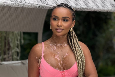 Natália Deodato reflete sobre o BBB: ‘A pressão estética é enorme’ 