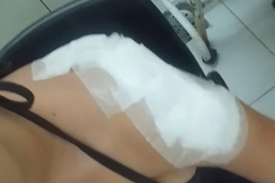 Passageira acusa motociclista de aplicativo de fugir sem prestar socorro após acidente em Guaratiba