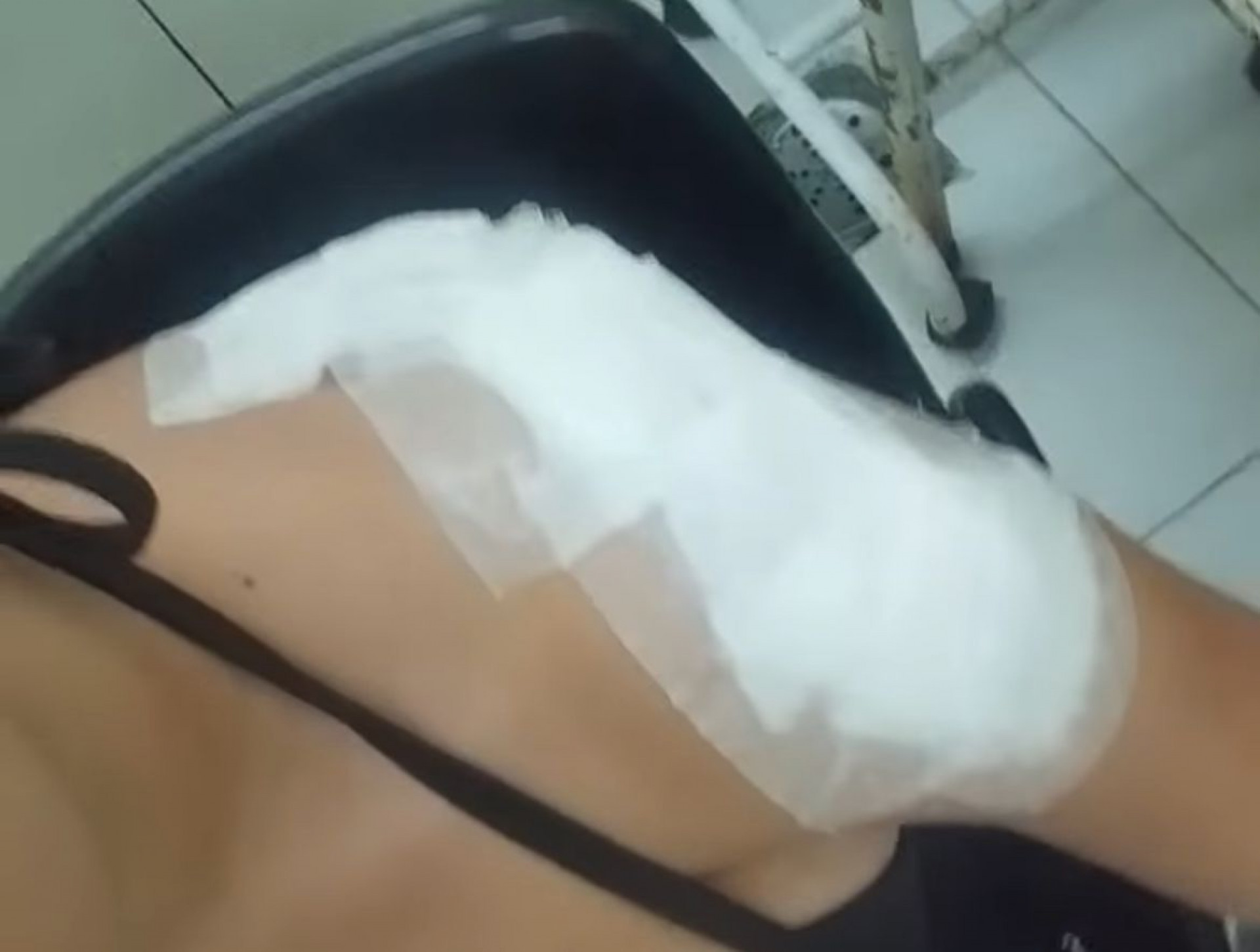 Bárbara Bernardes esteve nesta quinta-feira (23) em uma clínica para cuidar dos ferimentos - Reprodução / Redes Sociais