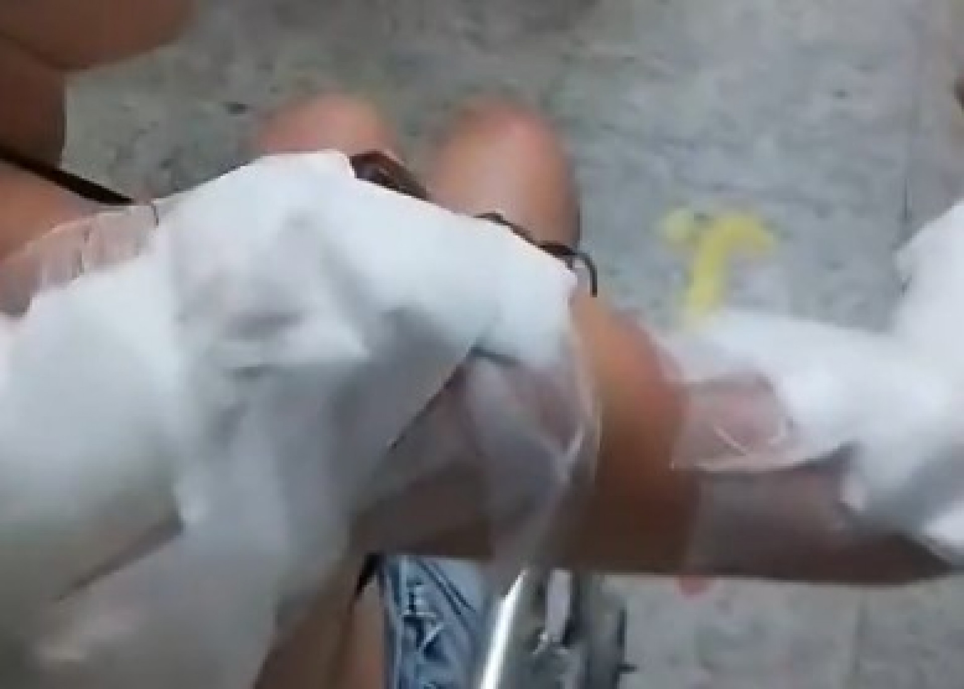 Vítima está cuidando dos ferimentos em diversas partes do corpo - Reprodução / TV Globo