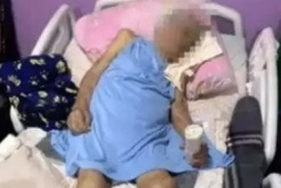 Idosa de 103 anos tem pé amputado em casa por enfermeira e sem anestesia