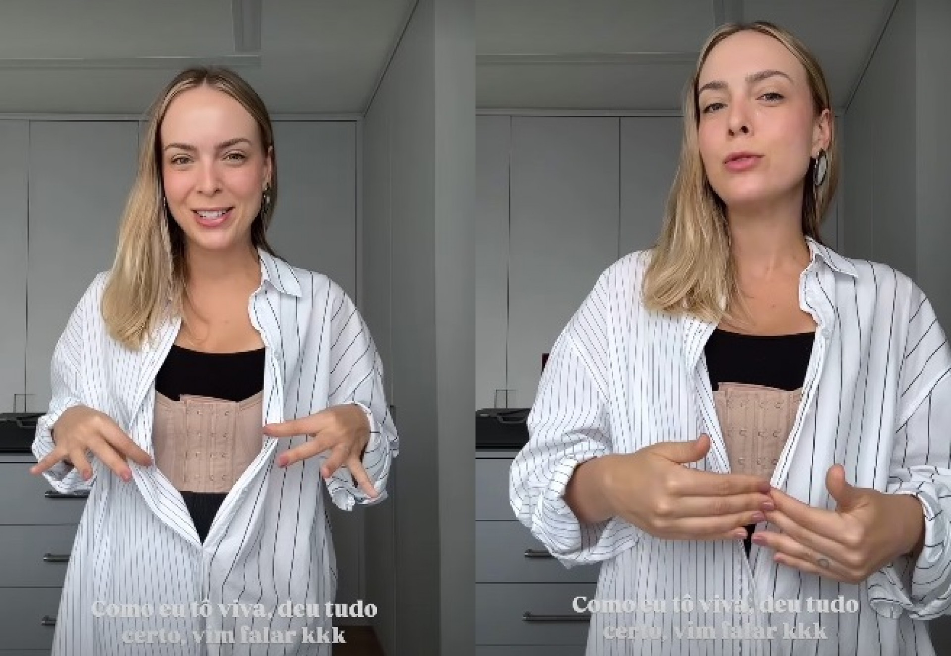 Tata Estaniecki se submeteu a procedimento estético - Reprodução/Instagram 