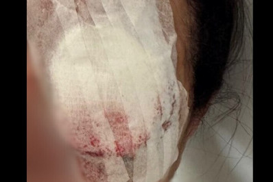 Mulher é presa após atacar idosa sem motivo e deixá-la cega de um olho