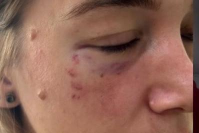 Homem agride fotógrafa com soco durante ‘Ensaios da Anitta’ no Rio