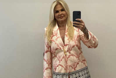 Monique Evans exibe antes e depois de harmonização facial: 'Fez milagre'