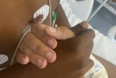 Influenciador baleado por PM apresenta melhora e já consegue andar