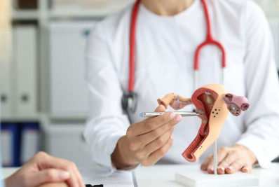 Adeus, Papanicolau? Entenda as mudanças no rastreamento do câncer do colo do útero