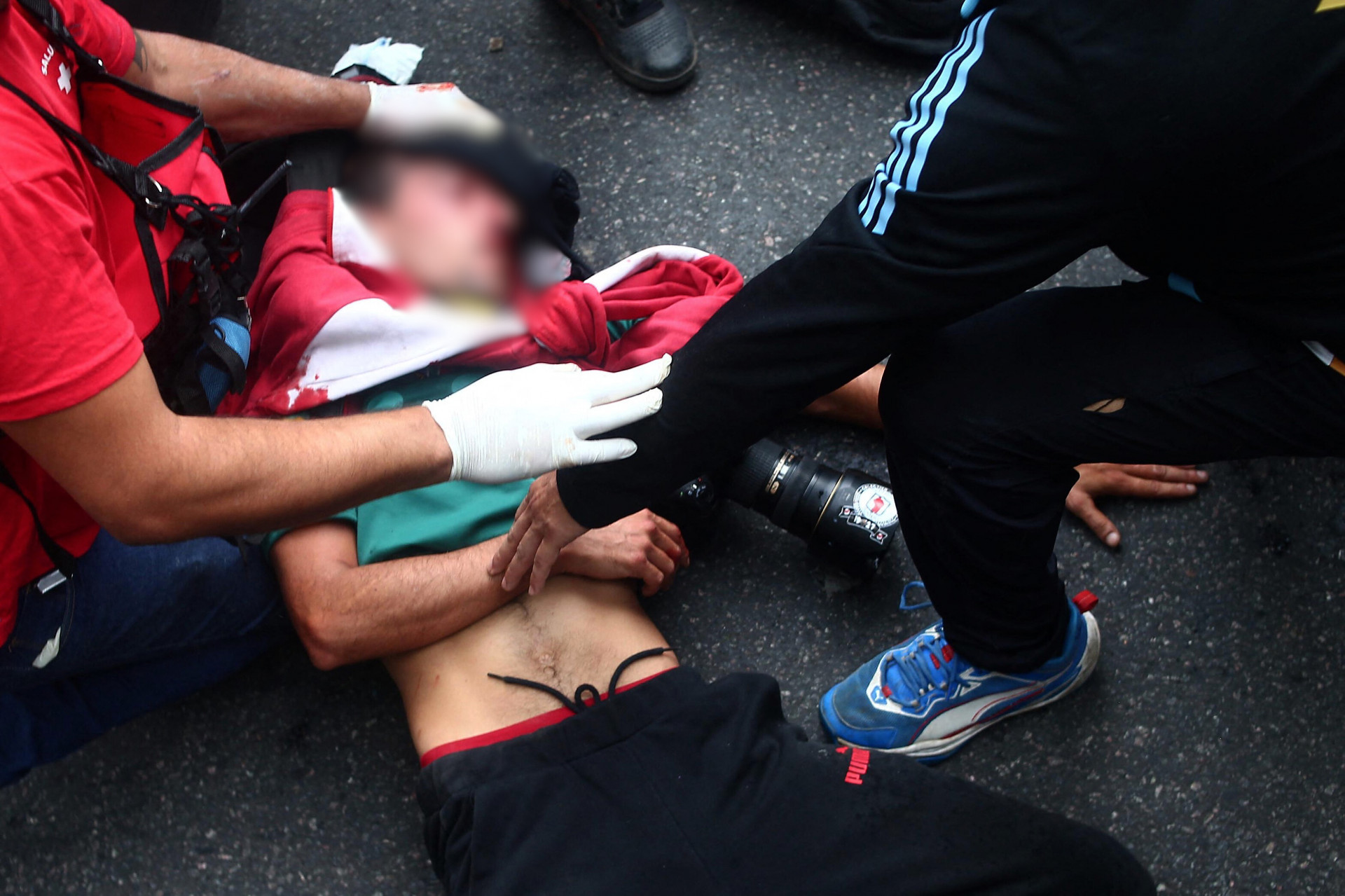 Fotojornalista foi atingido na cabeça durante protesto na Argentina - AFP
