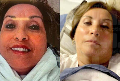 Investigada por suposta cirurgia no nariz, presidente peruana é alvo de polêmicas após vazamento de fotos