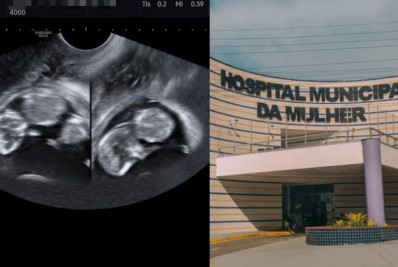 Jovem passa por cesárea em Cabo Frio após relatar gravidez de gêmeos, mas médicos não encontram bebês