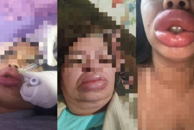 Falsa biomédica é indiciada após deformar rostos de mulheres