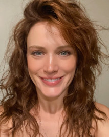 Bianca Bin mostra lábios inchados depois de reação alérgica: 'Parece herpes'