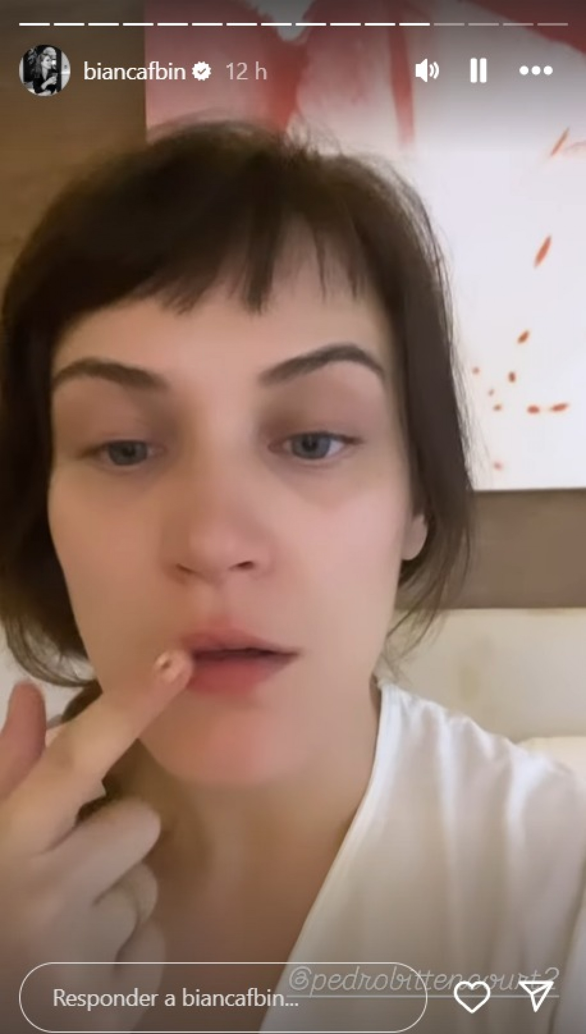 Bianca Bin contou que sofreu uma picada  - Reprodução Instagram