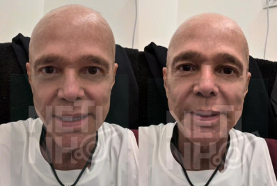 Netinho desmente rumores sobre saúde e inicia segunda fase do tratamento contra o câncer