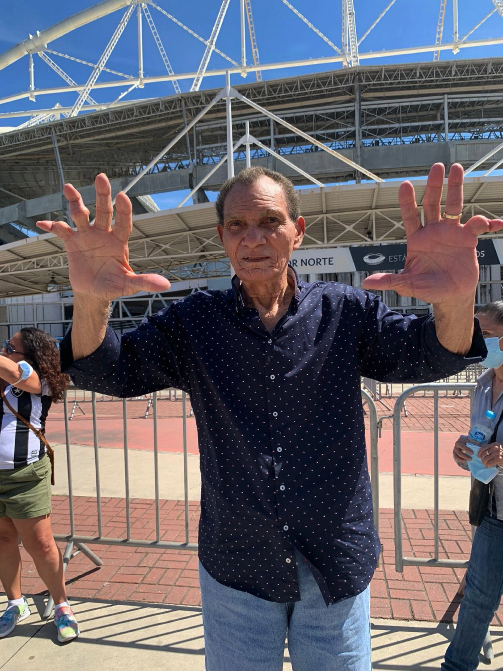 Manga mostra os dedos tortos em foto tirada em frente ao Estádio Nilton Santos