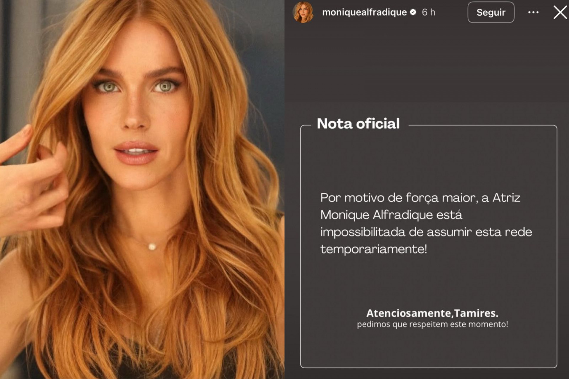 Monique Alfradique assusta fãs com post misterioso e vira alvo de críticas - Foto: Reprodução