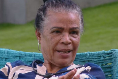 Tratamento contra o melasma: entenda a condição de Vilma, ex-BBB 25