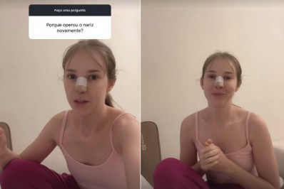 Sammy faz relato sobre cirurgias no nariz: 'Destruíram minha respiração'