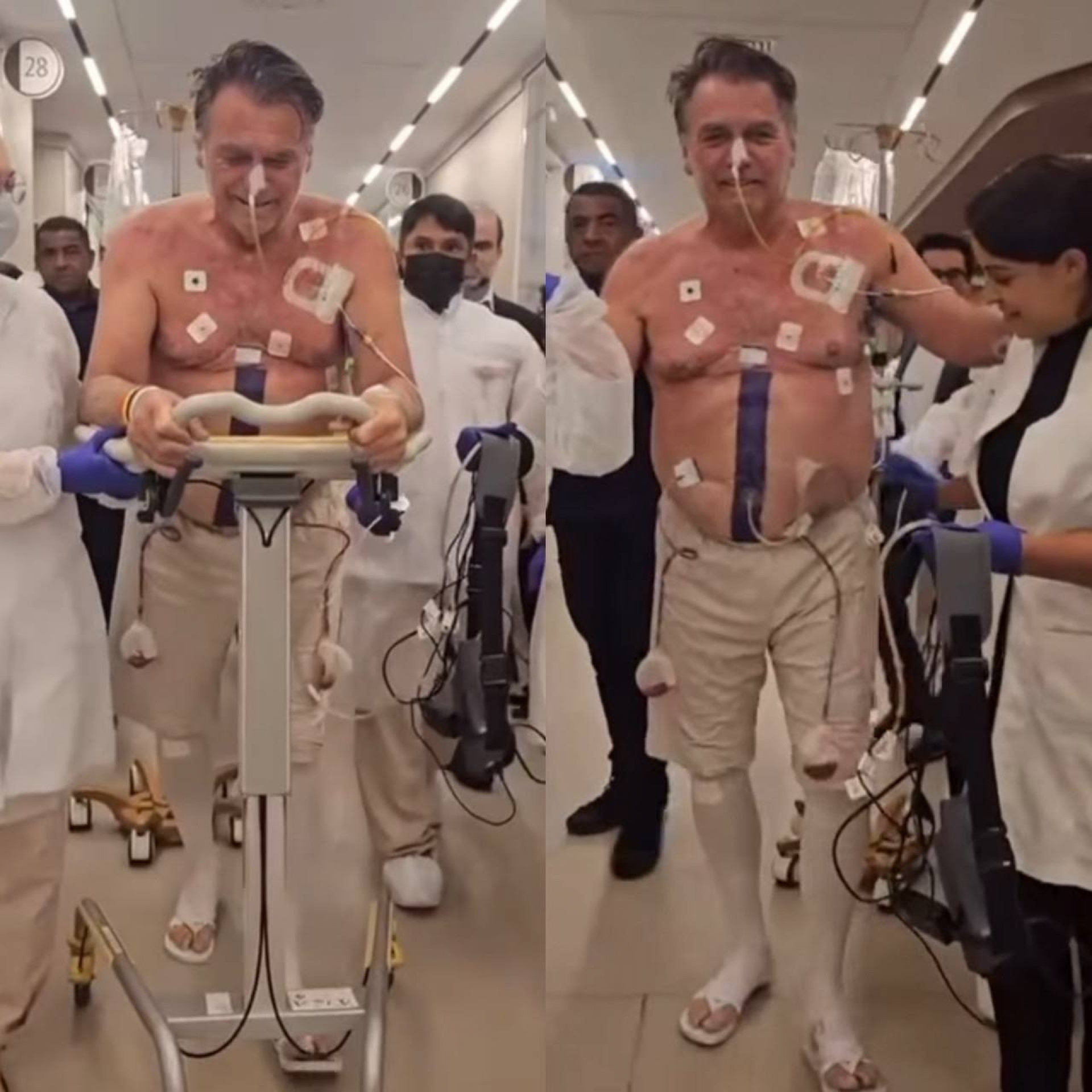 Bolsonaro passou por um procedimento de desobstru&ccedil;&atilde;o no intestino em Bras&iacute;lia  - Reprodu&ccedil;&atilde;o/v&iacute;deo/redes sociais