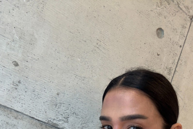 Ex-BBB Kerline reverte preenchimento labial: 'Meu rosto rejuvenesceu'